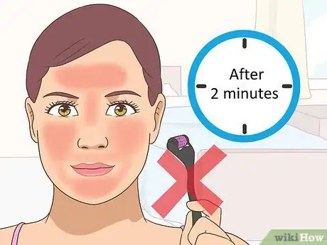 Image intitulée Use a Derma Roller Step 7