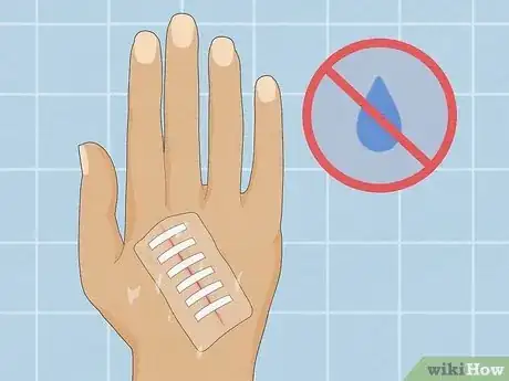 Image intitulée Take a Shower After Surgery Step 6