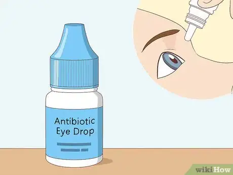 Image intitulée Clear a Blocked Tear Duct Step 8