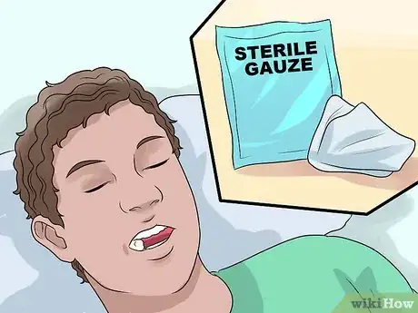 Image intitulée Pull Out a Tooth Without Pain Step 6