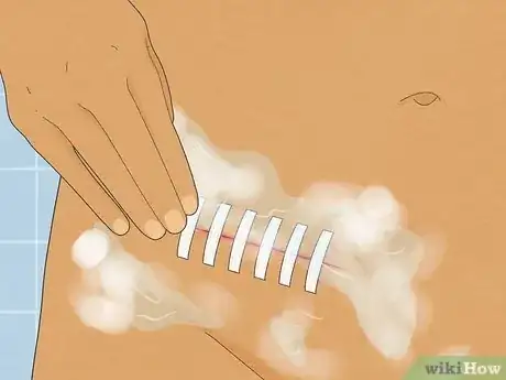 Image intitulée Take a Shower After Surgery Step 3