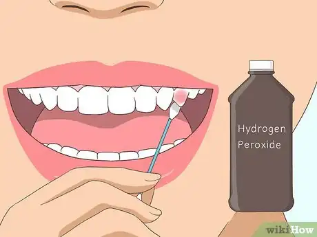 Image intitulée Cure a Toothache Step 12