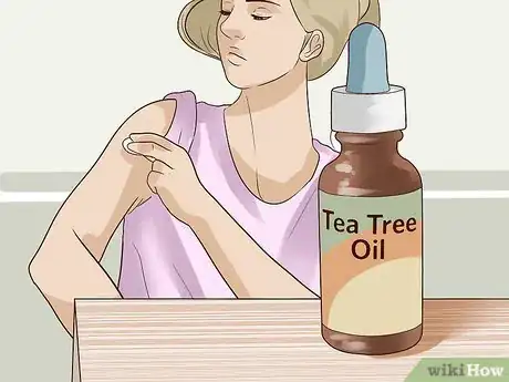 Image intitulée Get Rid of Skin Tags Step 9