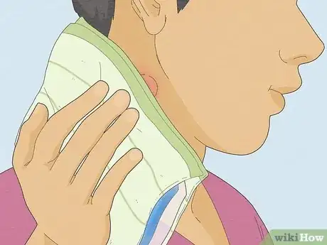 Image intitulée Reduce Lymph Node Swelling Step 4