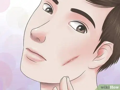 Image intitulée Get Rid of a Cut on Your Face Step 11