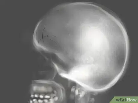 Image intitulée Get Rid of a Cut on Your Face Step 10