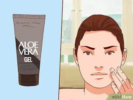 Image intitulée Get Rid of Pimples with Aloe Vera Gel Step 4