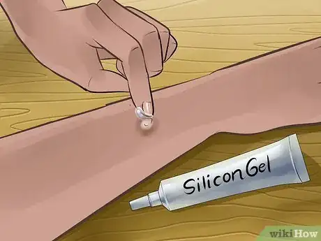Image intitulée Heal from a Skin Biopsy Step 15