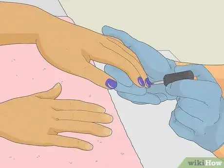 Image intitulée Stop Biting Your Nails Step 1