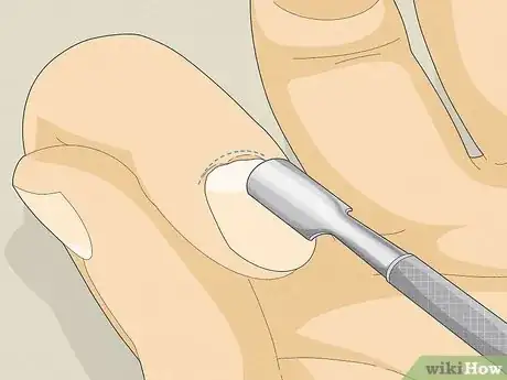 Image intitulée Stop Biting Your Nails Step 3