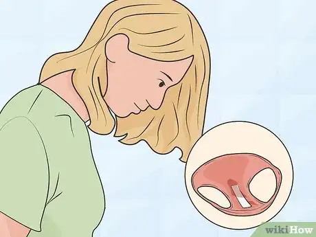 Image intitulée Identify an Amniotic Fluid Leak Step 07