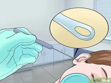 Image intitulée Remove Ear Wax Plugs Step 16