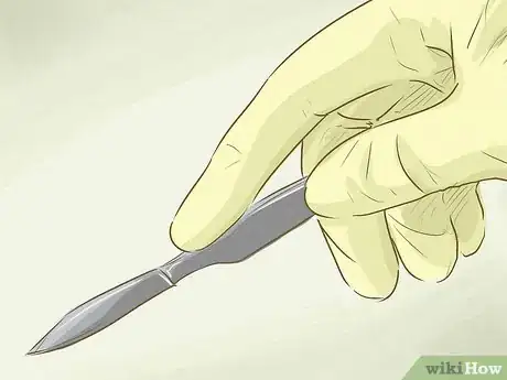 Image intitulée Get Rid of Keloids Step 9