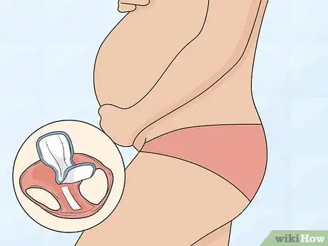 Image intitulée Identify an Amniotic Fluid Leak Step 01
