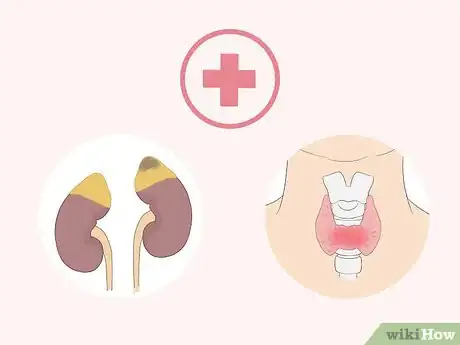 Image intitulée Lose Weight from Your Face Step 12