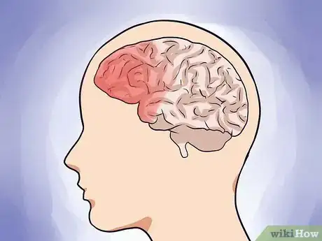 Image intitulée Cope With ADHD Step 47