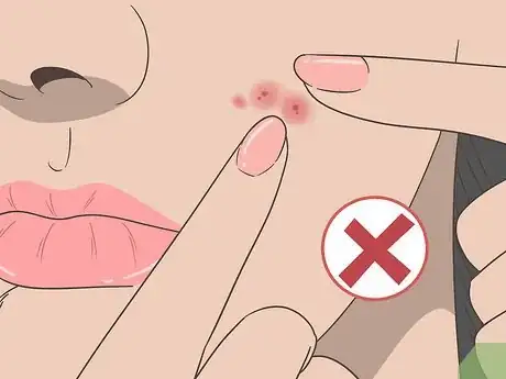 Image intitulée Create a Hot Compress for Acne Treatment and Skin Health Step 11