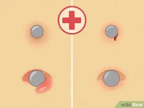 Image intitulée Care for a New Navel Piercing Step 17