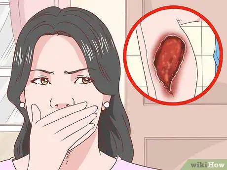 Image intitulée Know if You Have Jungle Rot Step 4
