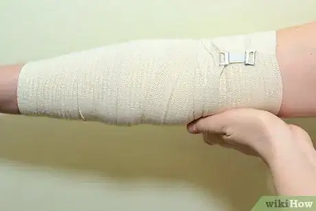 Image intitulée Strap an Elbow Step 6