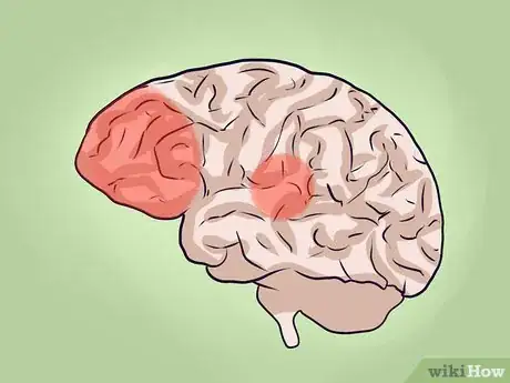 Image intitulée Cope With ADHD Step 46