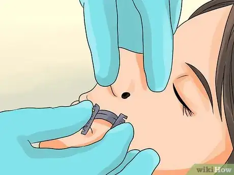 Image intitulée Remove a Raised Mole Step 3