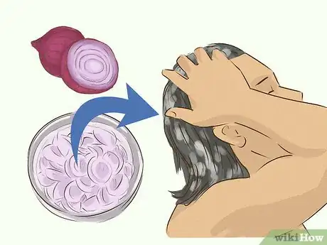 Image intitulée Grow Long Hair As a Guy Step 5