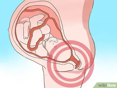 Image intitulée Induce Labor at Home Step 27