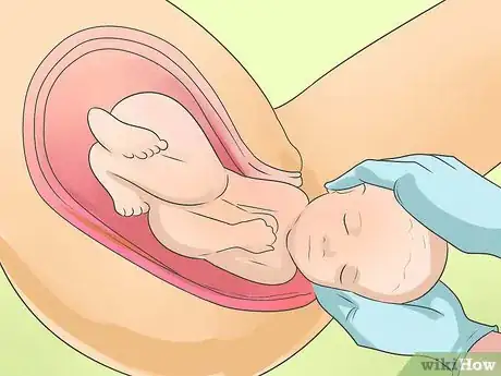 Image intitulée Deliver a Baby Step 9