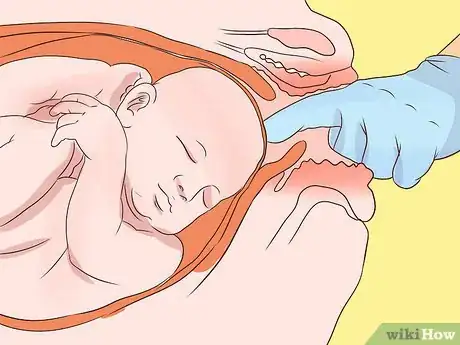 Image intitulée Induce Labor at Home Step 28