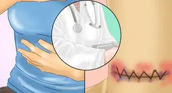 prendre soin d'une incision suite à une opération de la thyroïde