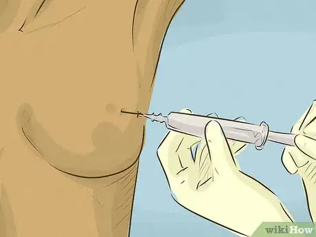 Image intitulée Identify a Lump in a Breast Step 8