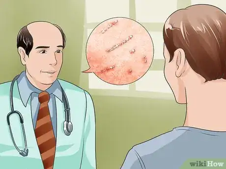 Image intitulée Recognize Scabies Rash Step 8
