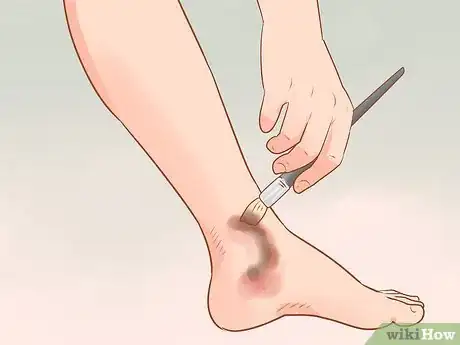 Image intitulée Fake an Injury Step 28