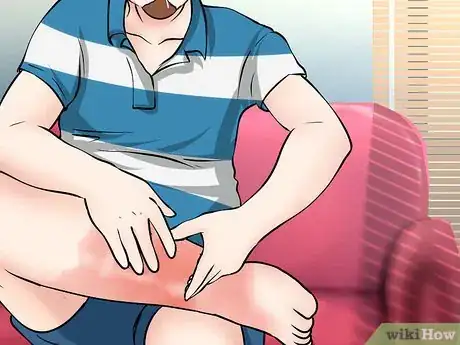 Image intitulée Prevent Lymphedema Step 17