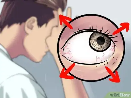Image intitulée Wash Eyes With Water Step 18