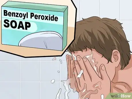 Image intitulée Use Tretinoin and Benzoyl Peroxide Concurrently Step 9