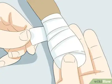 Image intitulée Stop a Dog's Quick from Bleeding Step 18