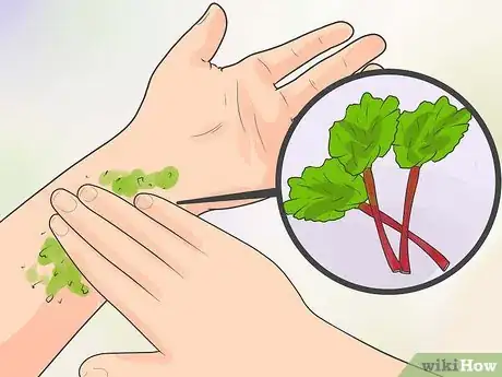 Image intitulée Naturally Stop Granuloma Annulare Step 11