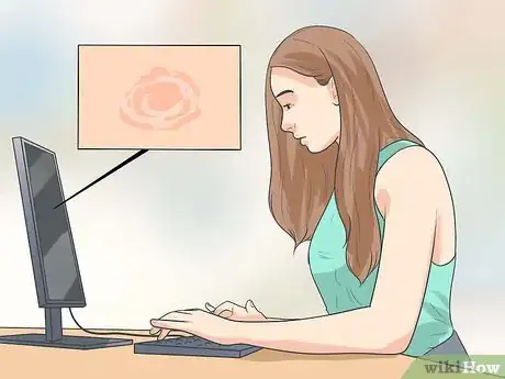 Image intitulée Naturally Stop Granuloma Annulare Step 14