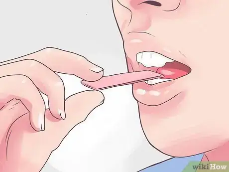Image intitulée Soothe a Burnt Tongue Step 10