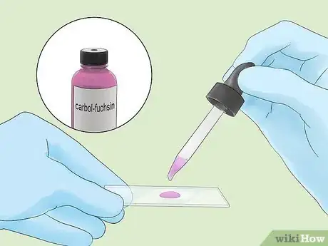Image intitulée Identify Bacteria Step 15