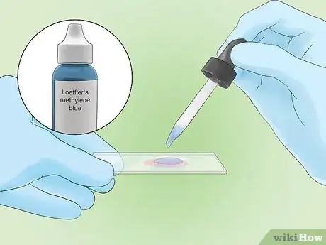 Image intitulée Identify Bacteria Step 20