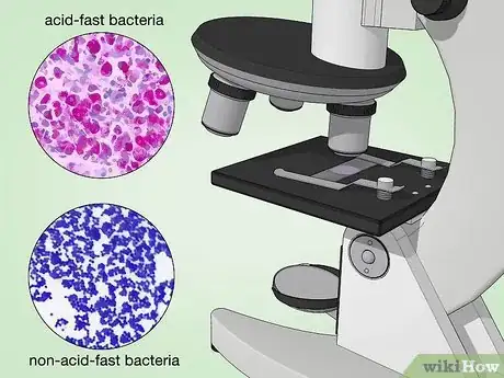 Image intitulée Identify Bacteria Step 22