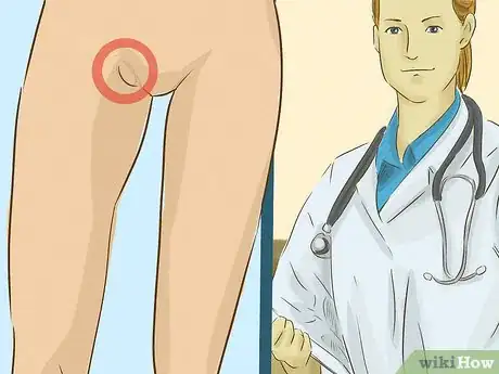 Image intitulée Treat a Groin Injury Step 14