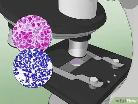 Image intitulée Identify Bacteria Step 10