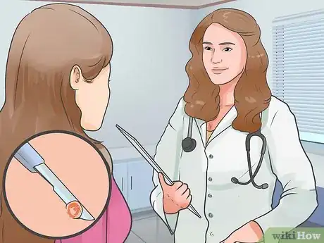 Image intitulée Naturally Stop Granuloma Annulare Step 16
