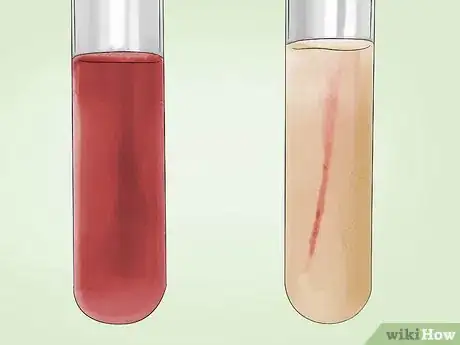 Image intitulée Identify Bacteria Step 25