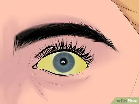 Image intitulée Know if You Have an Enlarged Liver Step 1