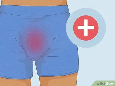 Image intitulée Cure Balanitis Step 8